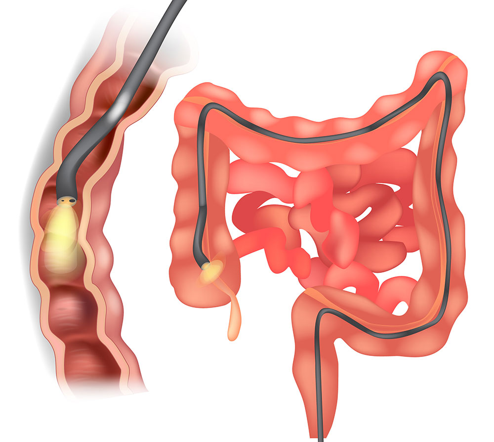 ce pregătiri sunt necesare