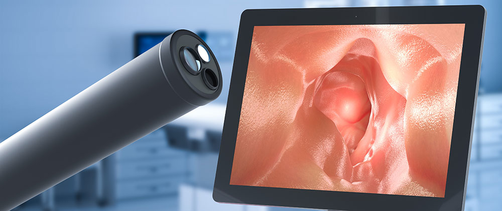 ce se întâmplă în timpul colonoscopiei